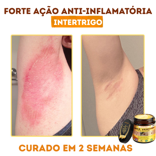 LOVILDS™ Creme multifuncional com veneno de abelha aprovado por dermatologistas dos EUA