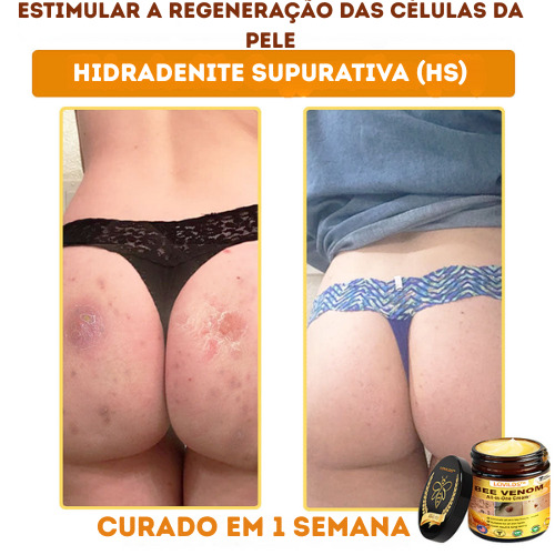 LOVILDS™ Creme multifuncional com veneno de abelha aprovado por dermatologistas dos EUA