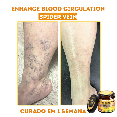 LOVILDS™ Creme multifuncional com veneno de abelha aprovado por dermatologistas dos EUA